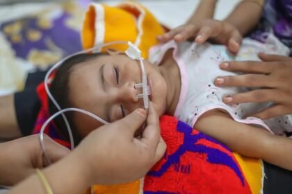 হাম ও হামের উপসর্গে আরও ৫ শিশুর মৃত্যু, নতুন আক্রান্ত ৯২৫