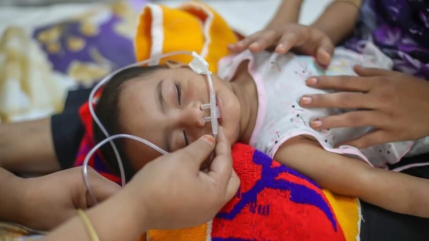 হাম ও হামের উপসর্গে আরও ৫ শিশুর মৃত্যু, নতুন আক্রান্ত ৯২৫